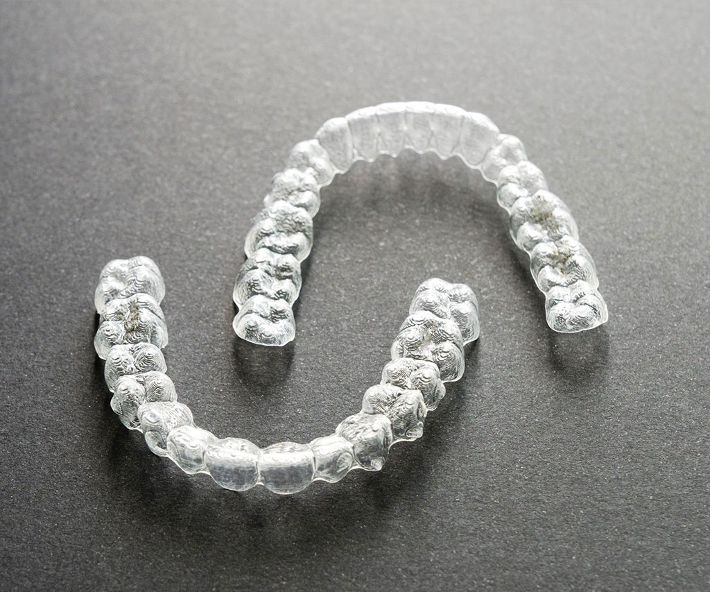 Izbeljivanje zuba 1 Ab Dental Izbeljivanje zuba2