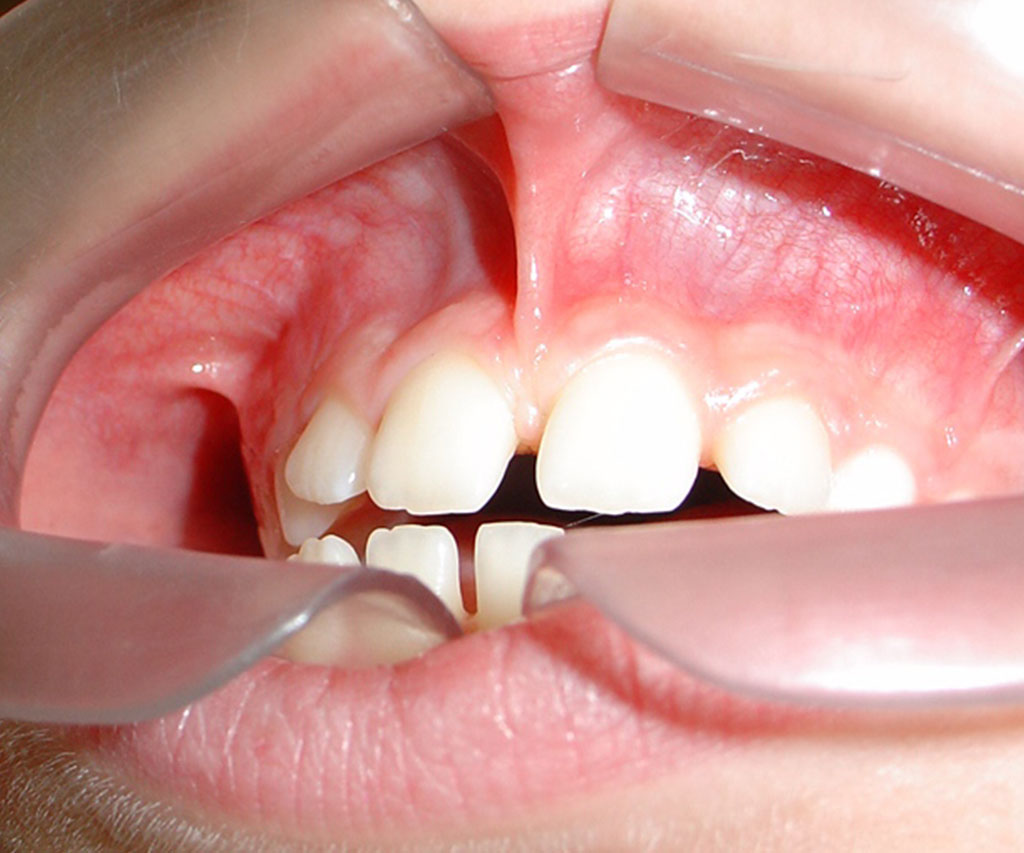 Oralna hirurgija 2 Ab Dental Oralna hirurgija2