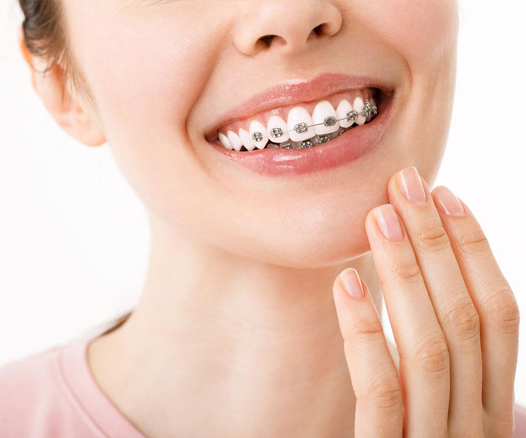 Ortodoncija 2 Ab Dental Ortodoncija 1