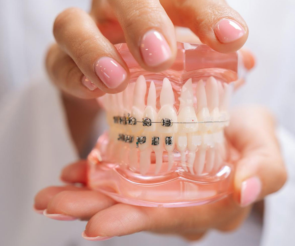 Ortodoncija 1 Ab Dental Ortodoncija 2