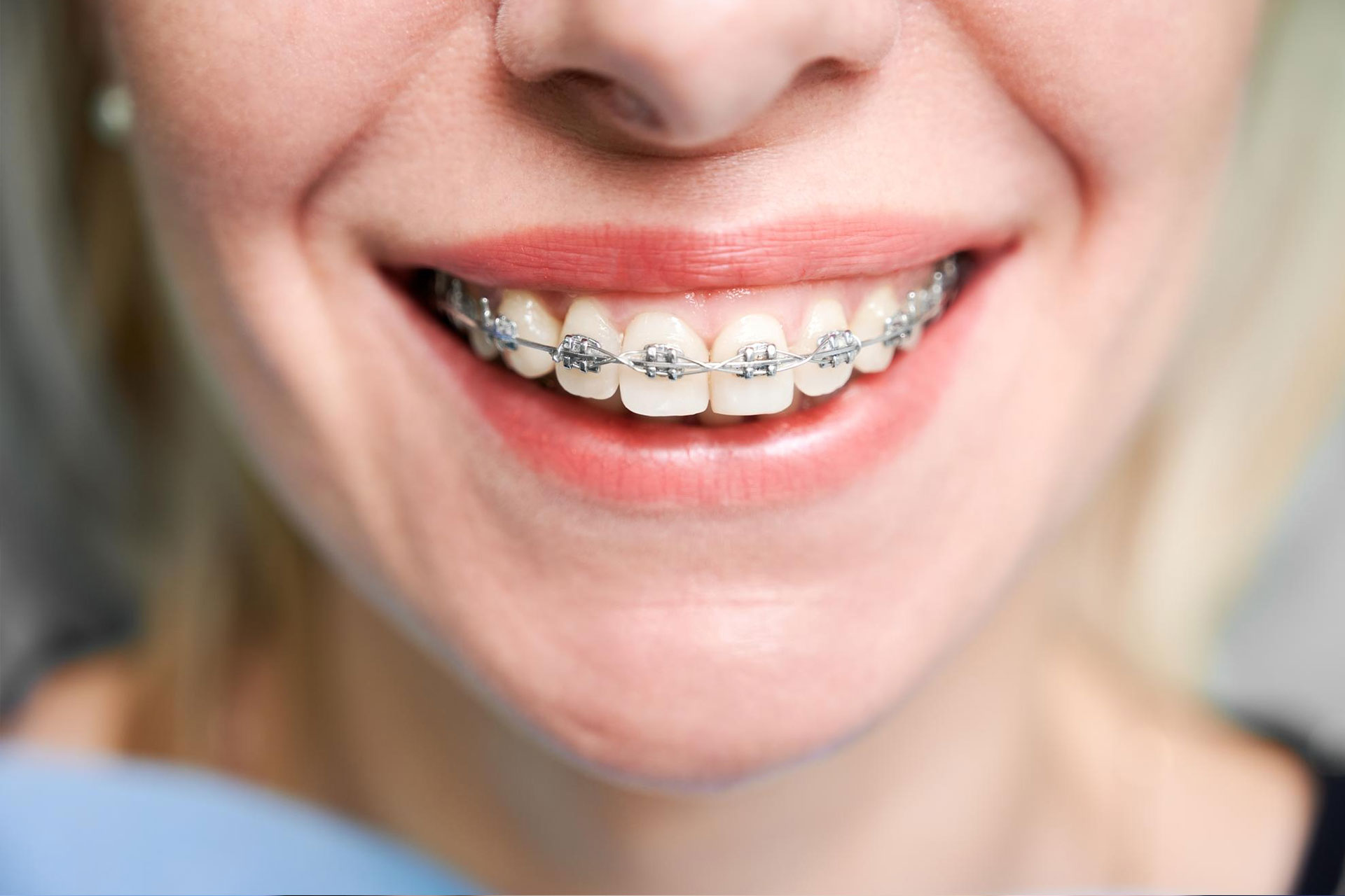 Ab-Dental-Ortodoncija3 Ab Dental Ortodoncija3
