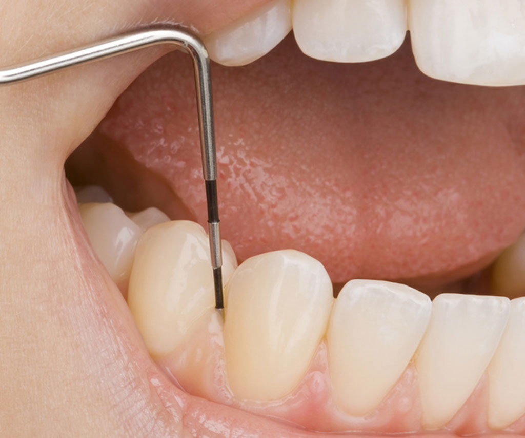 Parodontologija 2 Ab Dental Parodontologija1