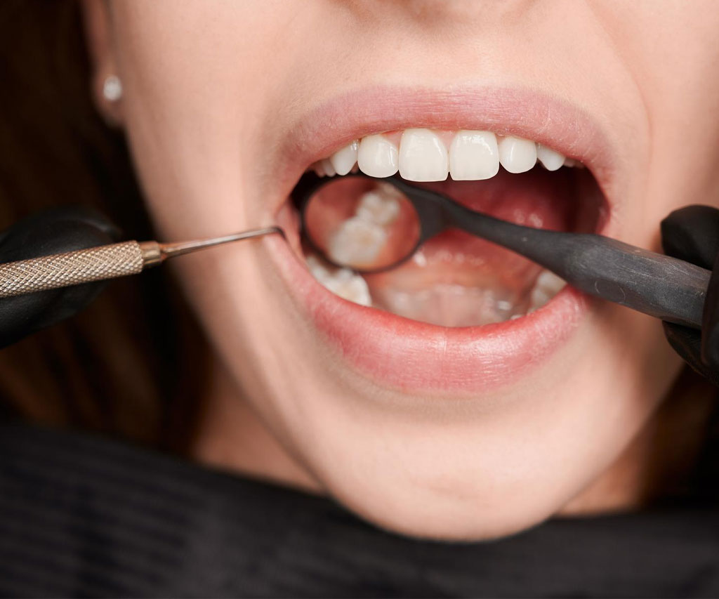 Opšta stomatologija 2 Ab Dental Opsta stomatologija zubni ispuni