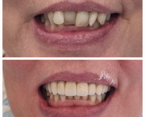 Ab Dental Nasi radovi 1