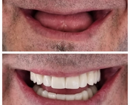 Ab Dental Nasi radovi 10
