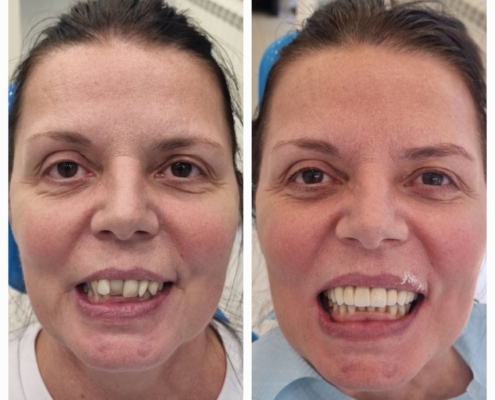 Ab Dental Nasi radovi 11