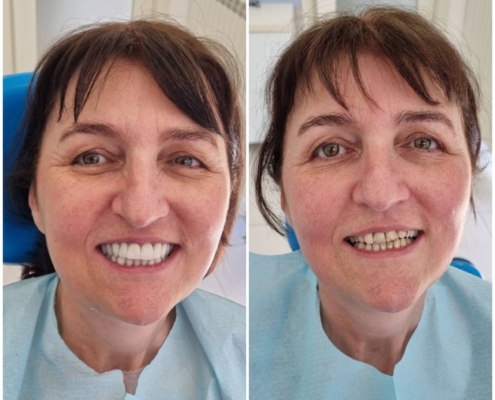 Ab Dental Nasi radovi 12