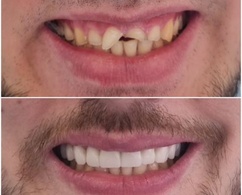 Ab Dental Nasi radovi 13