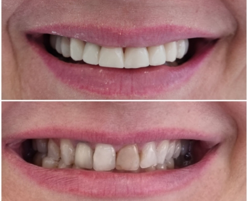 Ab Dental Nasi radovi 14