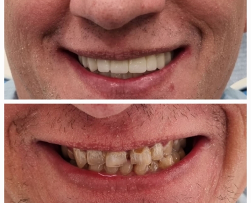 Ab Dental Nasi radovi 15