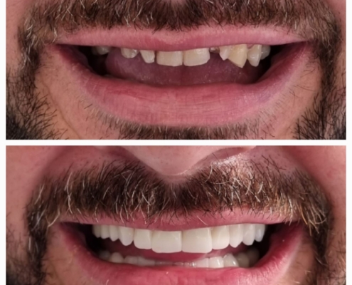 Ab Dental Nasi radovi 16