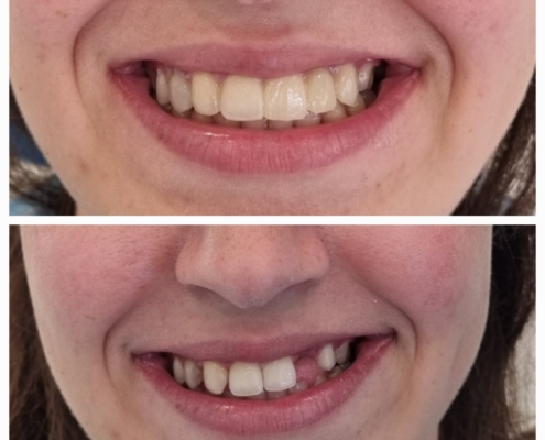 Ab Dental Nasi radovi 17