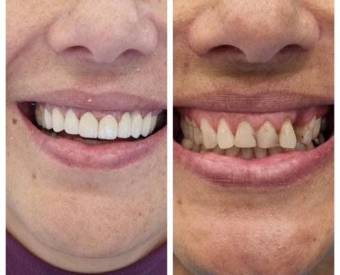 Ab Dental Nasi radovi 18