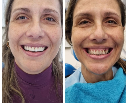 Ab Dental Nasi radovi 19
