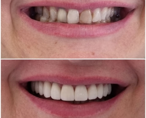 Ab Dental Nasi radovi 2