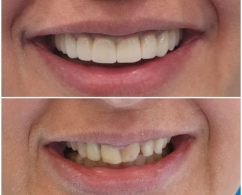 Ab Dental Nasi radovi 21