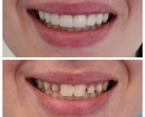 Ab Dental Nasi radovi 22