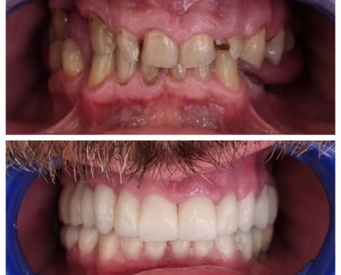 Ab Dental Nasi radovi 23