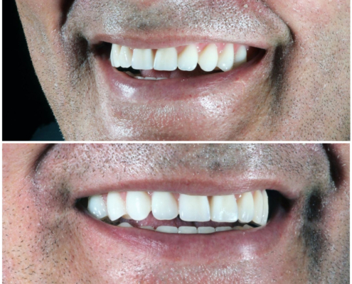 Ab Dental Nasi radovi 25 posle