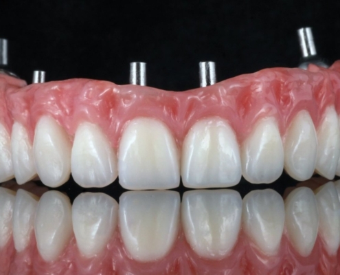 Ab Dental Nasi radovi 26