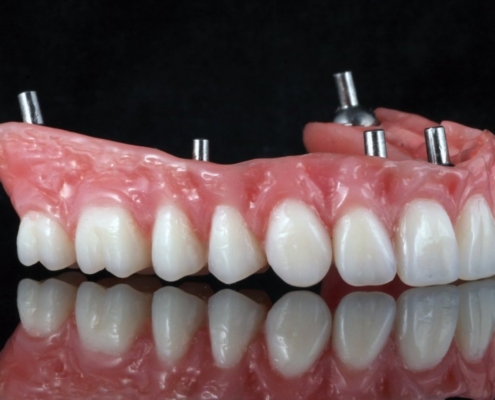 Ab Dental Nasi radovi 27