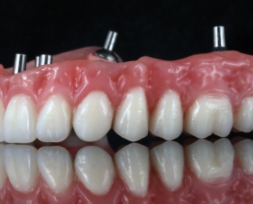 Ab Dental Nasi radovi 28