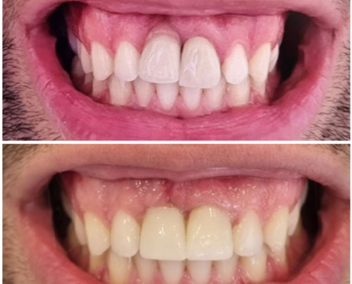 Ab Dental Nasi radovi 29 pre i posle
