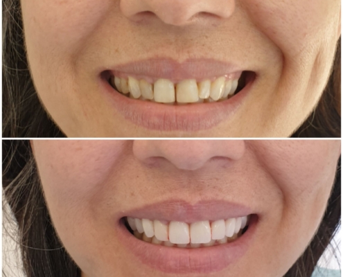 Ab Dental Nasi radovi 3