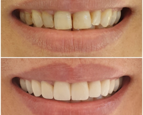Ab Dental Nasi radovi 5