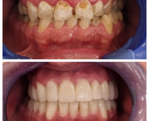 Ab Dental Nasi radovi 6