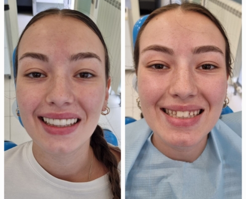Ab Dental Nasi radovi 7