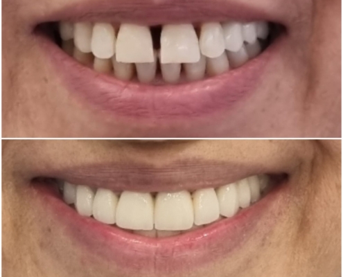 Ab Dental Nasi radovi 8