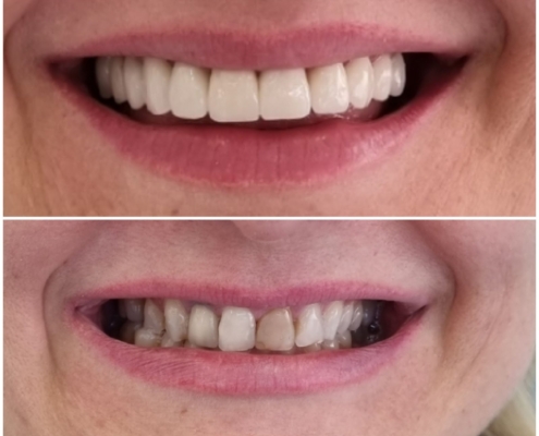 Ab Dental Nasi radovi 9